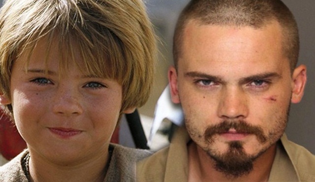 Hollywood Dedikoduları: Genç Anakin'e şizofreni teşhisi kondu