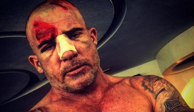 Hollywood Dedikoduları: Dominic Purcell'in, Prison Break setinde burnu kırıldı